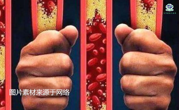 不想給血管“添堵”，盡量少吃以下這些東西，或許能讓腦梗離遠(yuǎn)些  